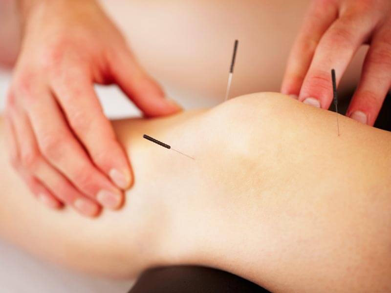 Short Ayurveda Tour Hambantota Gallery 3